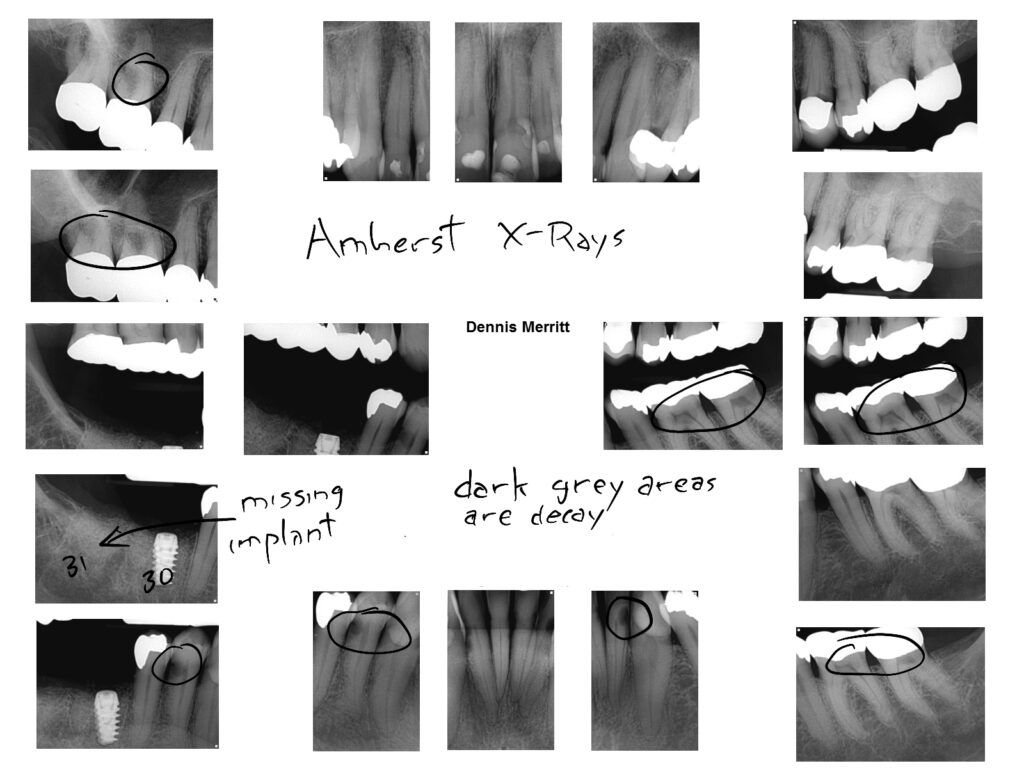 dental_x-rays.jpg