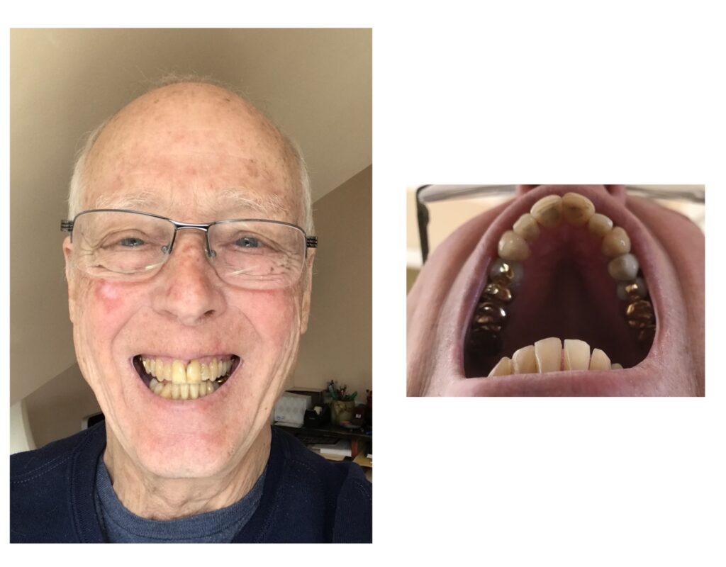 teeth_before.jpg